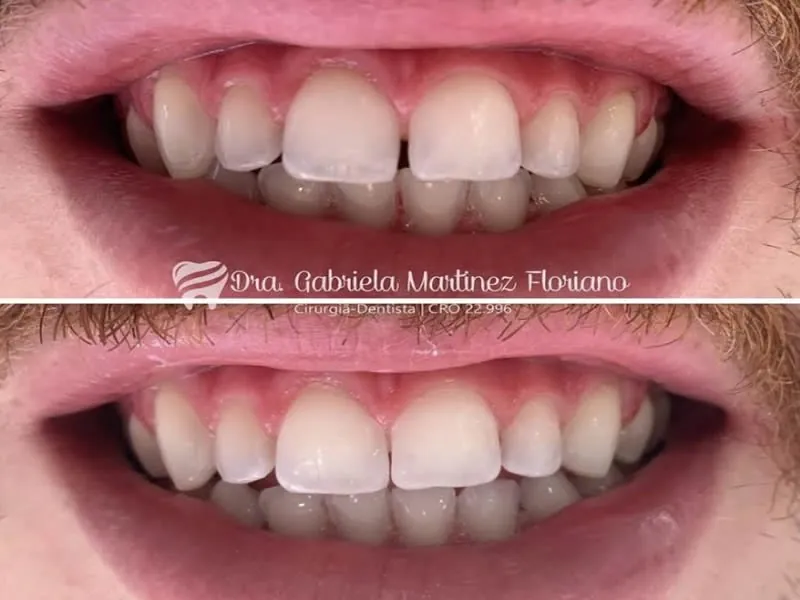 Odontopediatria